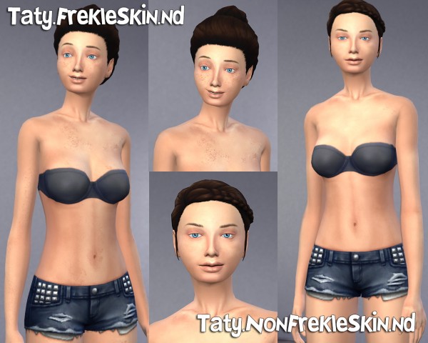  Taty: Frekle  skin
