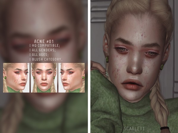  The Sims Resource: Acne 01 by Scarlett content