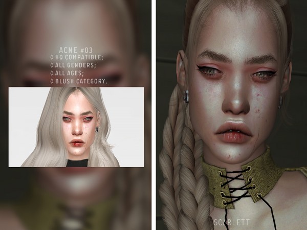  The Sims Resource: Acne 03 by Scarlett content