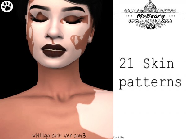  The Sims Resource: Vitiligo V3 by MsBeary