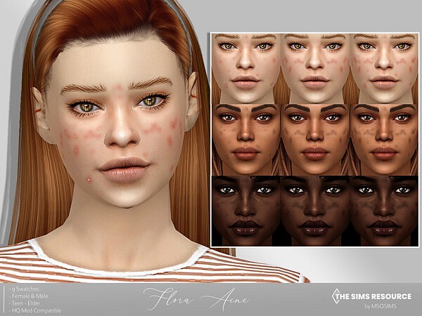 Flora Acne by MSQSIMS from TSR